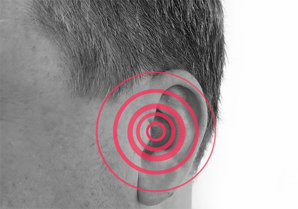 Đau tai giữa là dấu hiệu thường gặp của viêm tai giữa